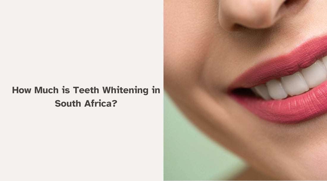 How Much is Teeth Whitening in South Africa?