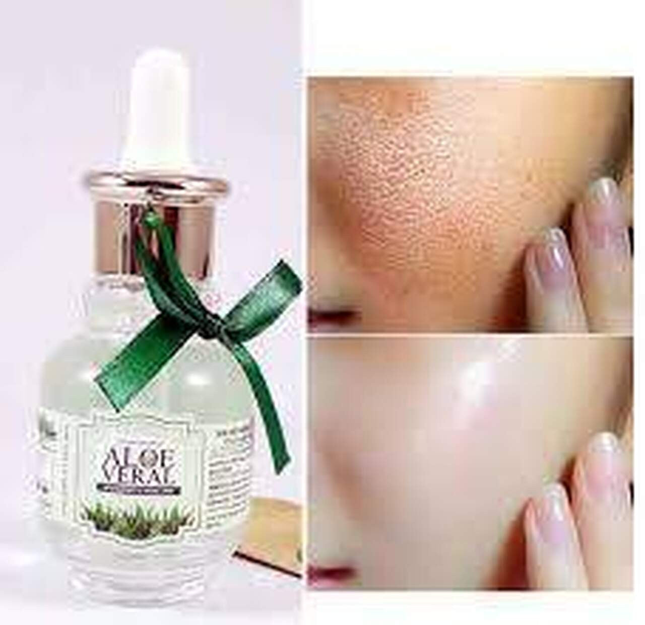4 in 1 Derma Roller Plus Anti Aging Aloe Vera Serum - Discount Dealz