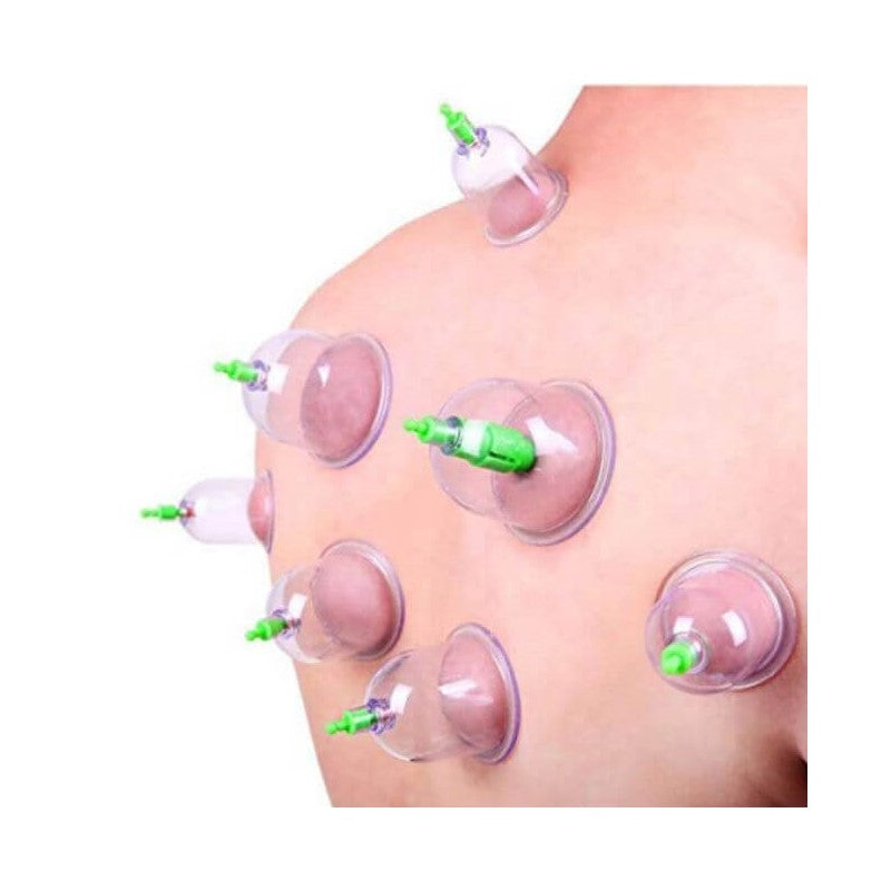 6 Pcs Chinese Body Cupping Massage Suction Therapy