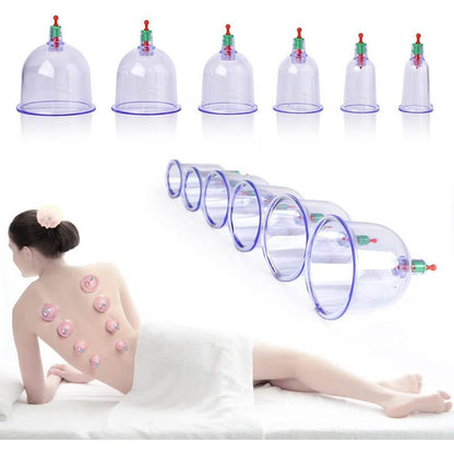 Chinese Cupping Vacuum 12pcs