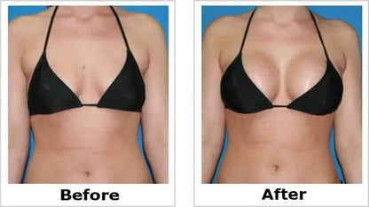 Breast Enlarging Cream2