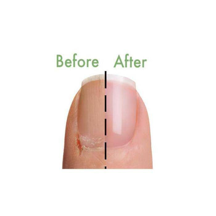 Healing Nail & Cuticle Mask 2