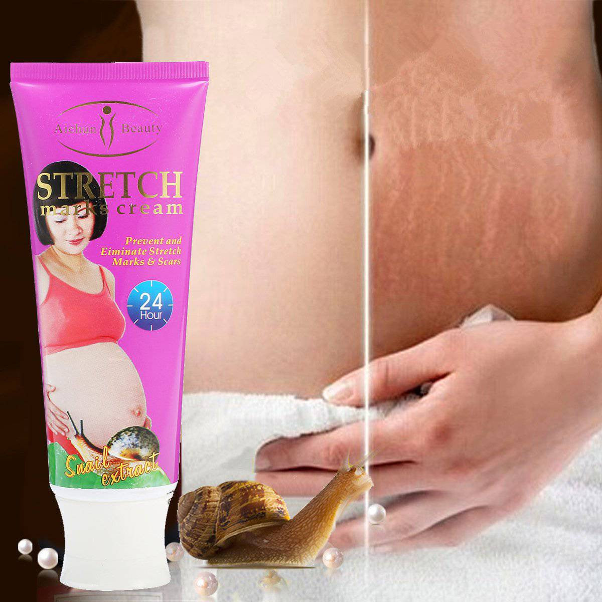 Snail Stretch Marks Cream1