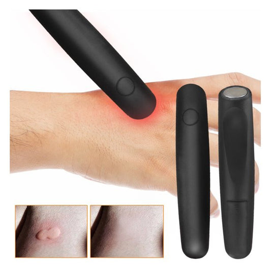 The Itch Therminator