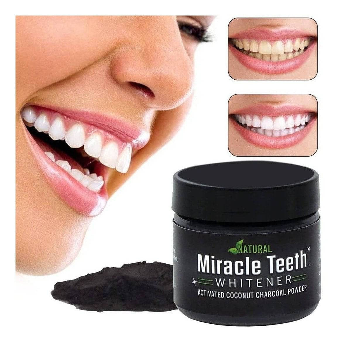 Miracle Teeth Whitener - Perfect-Dealz